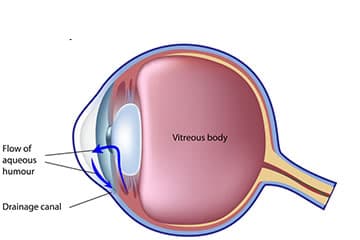 How raised pressure inside the eye damages the optic nerve