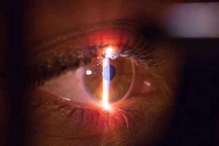Close-up of a patient's eye, the iris and lashes lit by the narrow beam of a slit lamp during an examination